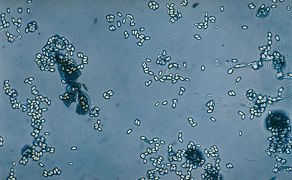 image_news_nosema_sporesi3udbh49w0h0both